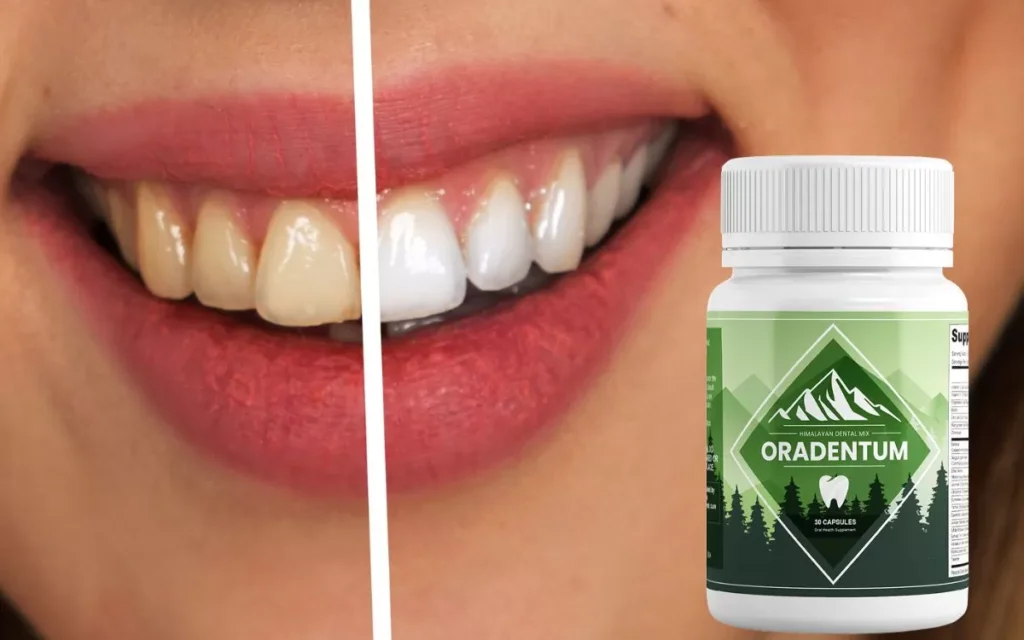 Oradentum Review