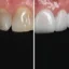 BioDentix Review: Advanced Dental Health Formula That Works